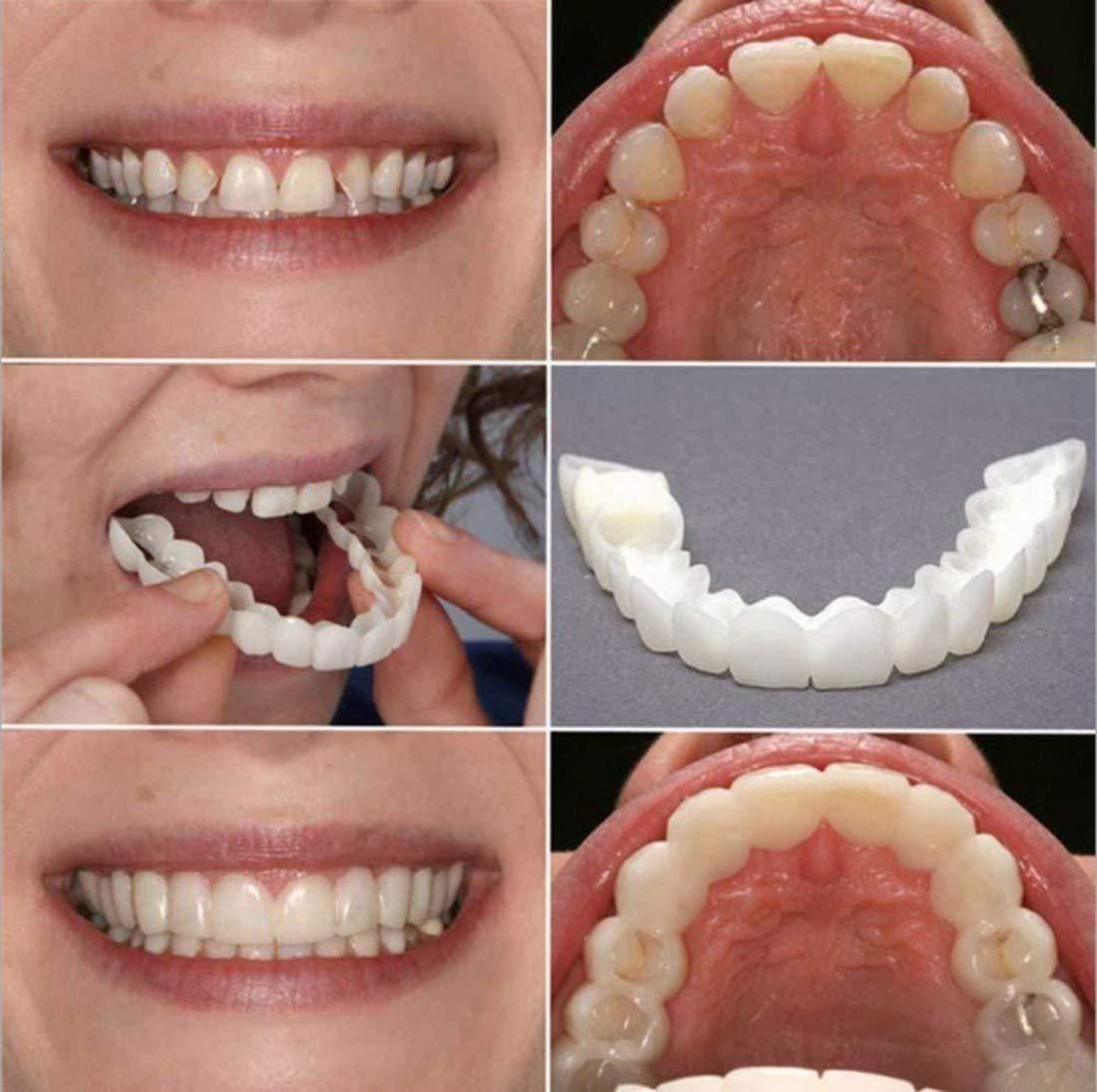 Instant Smile Fit Flex Cosmetic Denture
