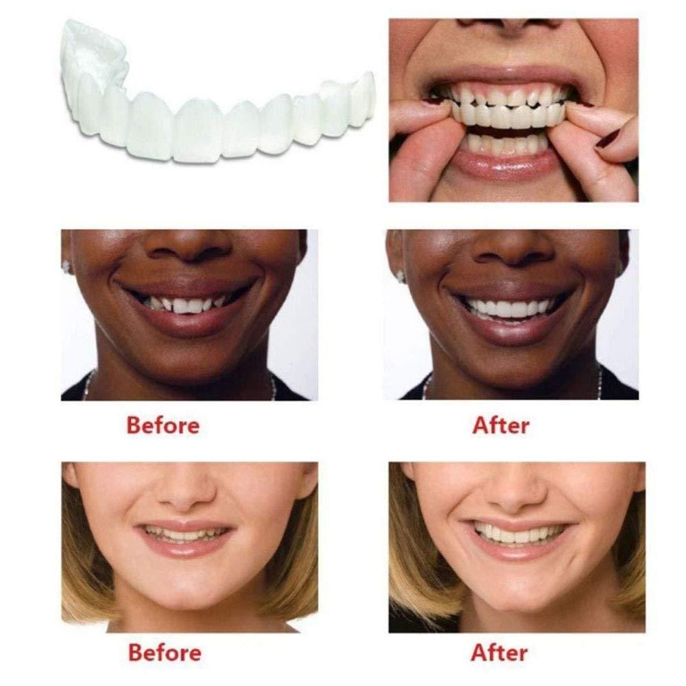 Instant Smile Fit Flex Cosmetic Denture